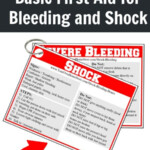 Shock And Severe Bleeding First Aid Basics Simple Family